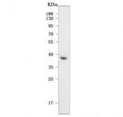 Western blot testing of human HCCT cell lysate with Paraoxonase 2 antibody. Predicted molecular weight: ~39/39/38 kDa (isoforms 1/2/3). 