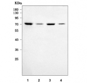Western blot testing of human 1) SH-SY5Y, 2) U-2 OS, 3) HEL and 4) Daudi cell lysate with Regulator of G-protein signaling 9 antibody. Predicted molecular weight: 50-77 kDa (multiple isoforms).