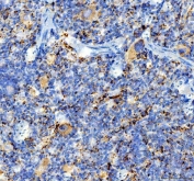 IHC staining of FFPE rat spleen tissue with ITGA2B antibody. HIER: boil tissue sections in pH8 EDTA for 20 min and allow to cool before testing.
