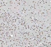 IHC staining of FFPE mouse brain tissue with RTCB antibody. HIER: boil tissue sections in pH8 EDTA for 20 min and allow to cool before testing.
