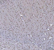 IHC staining of FFPE rat brain tissue with RTCB antibody. HIER: boil tissue sections in pH8 EDTA for 20 min and allow to cool before testing.