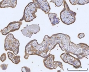 IHC staining of FFPE human placental tissue with PACSIN2 antibody. HIER: boil tissue sections in pH8 EDTA for 20 min and allow to cool before testing.