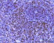 IHC staining of FFPE rat spleen tissue with PAX5 antibody. HIER: boil tissue sections in pH8 EDTA for 20 min and allow to cool before testing.