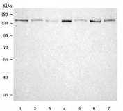 Western blot testing of 1) human HepG2, 2) human T-47D, 3) monkey COS-7, 4) rat liver, 5) rat brain, 6) mouse liver and 7) mouse brain tissue lysate with OPLAH antibody. Predicted molecular weight ~137 kDa.