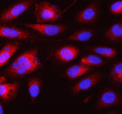 Immunofluorescent staining of FFPE human PC-3 cells with 4E-T antibody (red) and DAPI nuclear stain (blue). HIER: steam section in pH6 citrate buffer for 20 min.