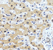 IHC staining of FFPE human liver tissue with ONECUT1 antibody, HRP-secondary and DAB substrate. HIER: boil tissue sections in pH8 EDTA for 20 min and allow to cool before testing.