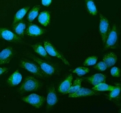 Immunofluorescent staining of FFPE human U-2 OS cells with 40S ribosomal protein S14 antibody (green) and DAPI nuclear stain (blue). HIER: steam section in pH6 citrate buffer for 20 min.