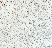 IHC staining of FFPE mouse brain tissue with 40S ribosomal protein S14 antibody. HIER: boil tissue sections in pH8 EDTA for 20 min and allow to cool before testing.