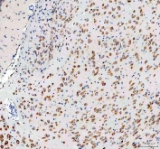 IHC staining of FFPE rat brain tissue with 40S ribosomal protein S14 antibody. HIER: boil tissue sections in pH8 EDTA for 20 min and allow to cool before testing.