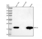 Immunoprecipitation of 40S ribosomal protein S14 protein from 500ug of human HeLa whole cell lysate with 2ug of 40S ribosomal protein S14 antibody.