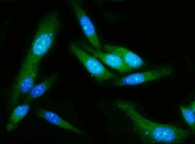 Immunofluorescent staining of FFPE human PC-3 cells with GSDMD antibody (green) and DAPI nuclear stain (blue). HIER: steam section in pH6 citrate buffer for 20 min.