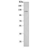 Western blot testing of human SH-SY5Y cell lysate with PLEKHG5 antibody. Predicted molecular weight ~122 kDa.