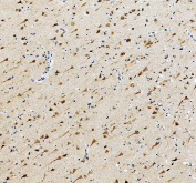 IHC staining of FFPE human brain tissue with PNPLA6 antibody, HRP-secondary and DAB substrate. HIER: boil tissue sections in pH8 EDTA for 20 min and allow to cool before testing.