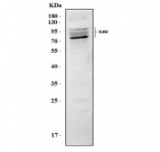 Western blot testing of mouse RAW264.7 cell lysate with Toll-like receptor 2 antibody. Predicted molecular weight: 85-90 kDa.