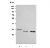 Western blot testing of 1) human SH-SY5Y, 2) rat brain and 3) mouse brain tissue lysate with Chronophin antibody. Predicted molecular weight ~32 kDa.