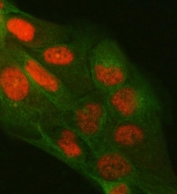 Immunofluorescent staining of FFPE human A431 cells with Protein phosphatase 1G antibody (red) and Alpha Tubulin mAb (green). HIER: steam section in pH6 citrate buffer for 20 min.