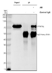 Immunoprecipitation of Protein phosphatase 1G protein from 500ug of human HeLa whole cell lysate with 2ug of Protein phosphatase 1G antibody.