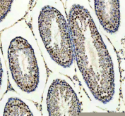 IHC staining of FFPE rat testis tissue with Protein phosphatase 1G antibody. HIER: boil tissue sections in pH8 EDTA for 20 min and allow to cool before testing.