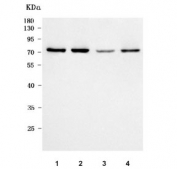 Western blot testing of human 1) HeLa, 2) 293T, 3) A431 and 4) Jurkat cell lysate with Protein phosphatase 1G antibody. Predicted molecular weight ~59 kDa, commonly observed at 59-75 kDa.