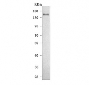 Western blot testing of human HeLa cell lysate with LDLR antibody. Expected molecular weight: 95-160 kDa depending on glycosylation level.