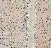 IHC staining of FFPE rat brain tissue with OTT1 antibody, HRP-secondary and DAB substrate. HIER: boil tissue sections in pH8 EDTA for 20 min and allow to cool before testing.