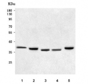 Western blot testing of 1) human ThP-1, 2) human MCF7, 3) rat liver, 4) rat kidney and 5) rat PC-12 cell lysate with NAAA antibody. Predicted molecular weight ~40/36/22 kDa (multiple isoforms).