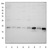 Western blot testing of 1) human MCF7, 2) human HL60, 3) human PC-3, 4) human 293T, 5) rat ovary, 6) rat brain, 7) mouse ovary and 8) mouse brain tissue lysate with NDUFB7 antibody. Predicted molecular weight ~16 kDa.
