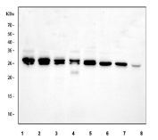Western blot testing of 1) human Caco-2, 2) human HEL, 3) human A549, 4) human K562, 5) rat brain, 6) rat liver, 7) mouse brain and 8) mouse liver tissue lysate with PRTFDC1 antibody. Predicted molecular weight ~26 kDa, ~22 kDa, ~20 kDa (three isoforms).