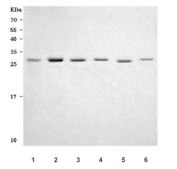Western blot testing of 1) human Caco-2, 2) human HeLa, 3) human A549, 4) human K562, 5) rat brain and 6) mouse brain tissue lysate with PRTFDC1 antibody. Predicted molecular weight ~26 kDa, ~22 kDa, ~20 kDa (three isoforms).