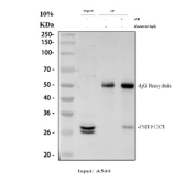 Immunoprecipitation of PRTFDC1 protein from 500ug of human A549 whole cell lysate with 2ug of PRTFDC1 antibody.