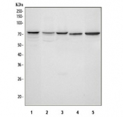 Western blot testing of 1) human HepG2, 2) human 293T, 3) human Jurkat, 4) rat brain and 5) mouse brain lysate with PPP2R5D antibody. Predicted molecular weight ~58 kDa, ~66 kDa and ~70 kDa (multiple isoforms).