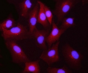 Immunofluorescent staining of FFPE human A549 cells with Biliverdin reductase B antibody (red) and DAPI nuclear stain (blue). HIER: steam section in pH6 citrate buffer for 20 min.