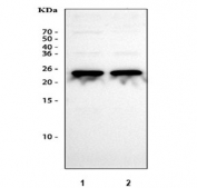 Western blot testing of human 1) HeLa and 2) 293T cell lysate with PSMB2 antibody. Predicted molecular weight ~23 kDa.