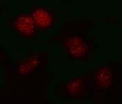 Immunofluorescent staining of FFPE human HeLa cells with PSMB2 antibody (red). HIER: steam section in pH6 citrate buffer for 20 min.