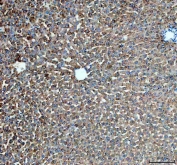 IHC staining of FFPE rat liver tissue with PYGL antibody. HIER: boil tissue sections in pH8 EDTA for 20 min and allow to cool before testing.