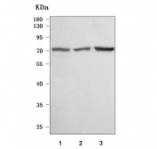 Western blot testing of human 1) MCF7, 2) 293T and 3) RT4 cell lysate with TTC39A antibody. Predicted molecular weight ~70 kDa.