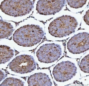 IHC staining of FFPE rat testis tissue with PRMT7 antibody. HIER: boil tissue sections in pH8 EDTA for 20 min and allow to cool before testing.