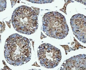 IHC staining of FFPE mouse testis tissue with PRMT7 antibody. HIER: boil tissue sections in pH8 EDTA for 20 min and allow to cool before testing.