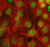 Immunofluorescent staining of FFPE human Caco-2 cells with PRMT7 antibody (green) and Alpha Tubulin mAb (red). HIER: steam section in pH6 citrate buffer for 20 min.