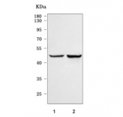 Western blot testing of human 1) HeLa and 2) SiHa cell lysate with TTC38 antibody. Predicted molecular weight ~53 kDa.