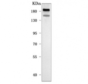 Western blot testing of human 293T cell lysate with Neuralized-like protein 4 antibody. Predicted molecular weight ~167 kDa.