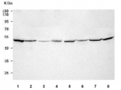 Western blot testing of 1) human HaCaT, 2) human MCF7, 3) human U-2 OS, 4) human A431, 5) rat brain, 6) rat kidney, 7) mouse brain and 8) mouse kidney tissue lysate with PPM1J antibody. Predicted molecular weight ~55 kDa.
