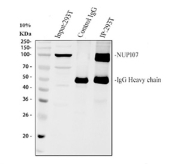 Immunoprecipitation of Nucleoporin 107 protein from 500ug of human 293T whole cell lysate with 2ug of Nucleoporin 107 antibody.