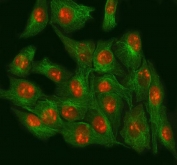 Immunofluorescent staining of FFPE rat NRK cells with NSUN2 antibody (green) and Alpha Tubulin mAb (red). HIER: steam section in pH6 citrate buffer for 20 min.