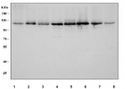 Western blot testing of human 1) HEL, 2) Caco-2, 3) A549, 4) HeLa, 5) RT4, 6) 293T, 7) SiHa and 8) U-251 cell lysate with Nucleolar protein 2 antibody. Predicted molecular weight: 89 kDa but routinely observed at 100~120 kDa.