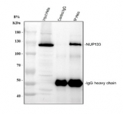 Immunoprecipitation of NUP133 protein from 500ug of human HeLa whole cell lysate with 2ug of NUP133 antibody.