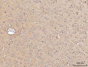 IHC staining of FFPE mouse brain tissue with MARK3 antibody. HIER: boil tissue sections in pH8 EDTA for 20 min and allow to cool before testing.