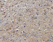 IHC staining of FFPE rat brain tissue with MARK3 antibody. HIER: boil tissue sections in pH8 EDTA for 20 min and allow to cool before testing.