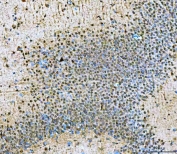 IHC staining of FFPE rat brain tissue with NVL antibody. HIER: boil tissue sections in pH8 EDTA for 20 min and allow to cool before testing.