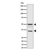 Western blot testing of human HeLa cell lysate with BAG family molecular chaperone regulator 1 antibody. Predicted molecular weight ~50 kDa (long form), 29-33 (short form).